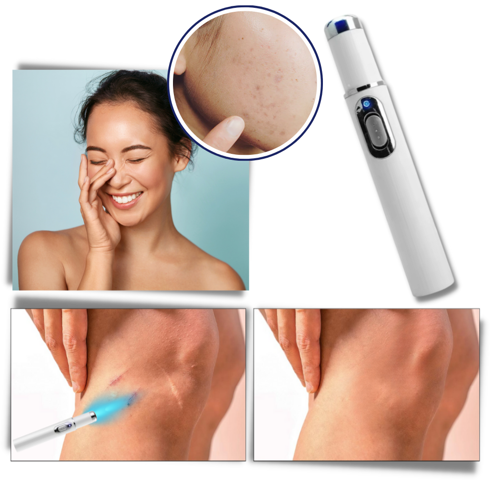 DermaPure | Draagbare Lasertherapie voor een Stralende Huid
