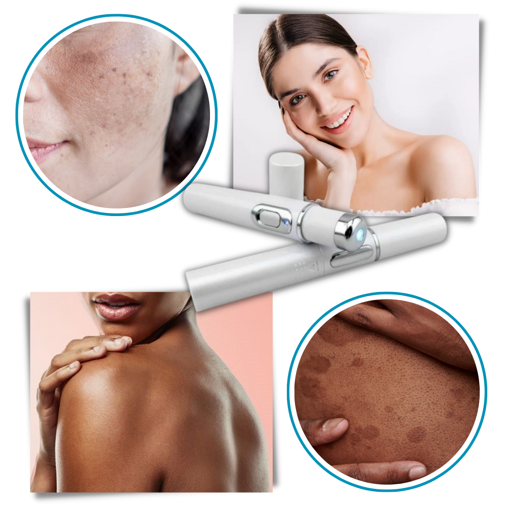 DermaPure | Draagbare Lasertherapie voor een Stralende Huid