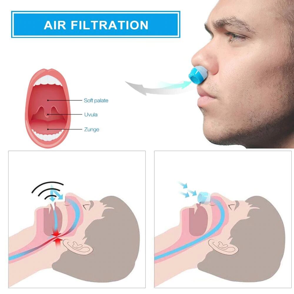 Emeja | Anti-Snurkapparaat | Tubeless, Maskervrij Micro-CPAP