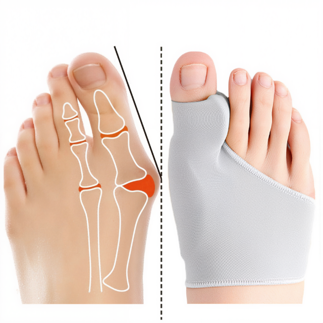 Emeja | Bunion Corrector Gel Pad voor Verlichting van Voetpijn