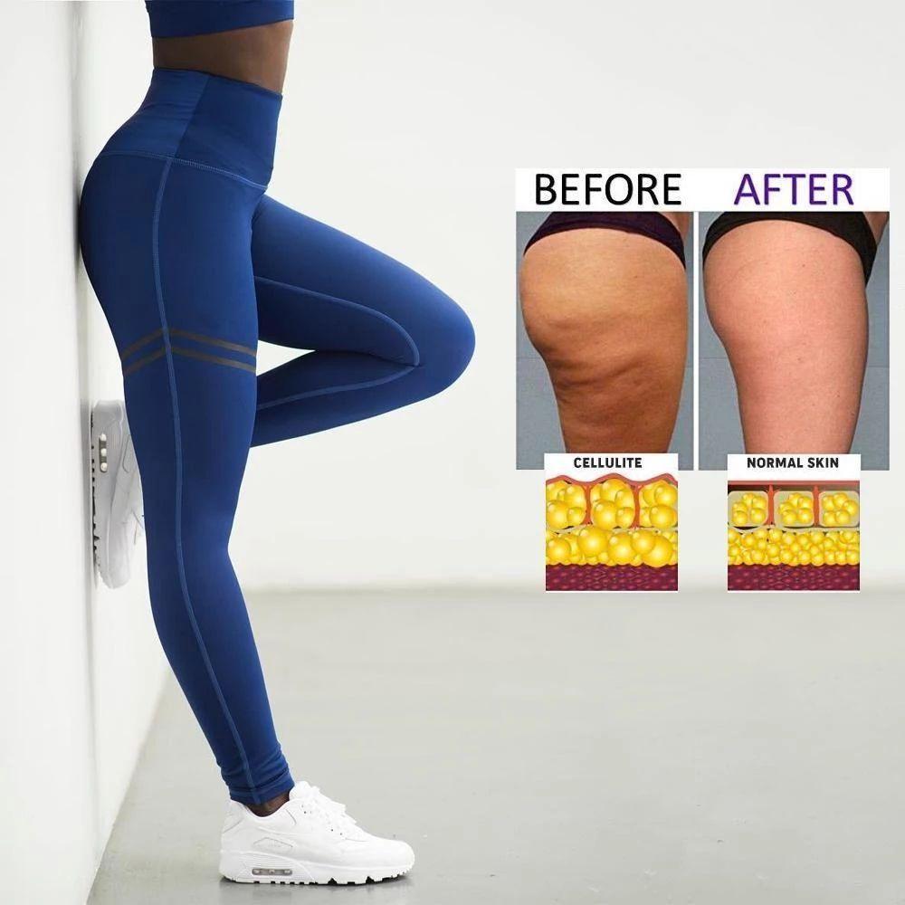 Emeja | Dames Anti-Cellulite Compressie Leggings