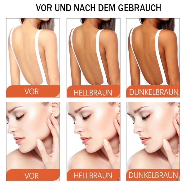 Emeja™ Intensieve Zonnebrand Gel