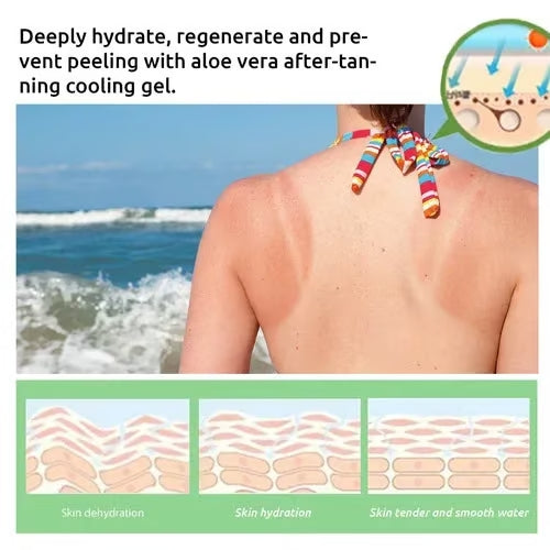 Emeja™ Intensieve Zonnebrand Gel