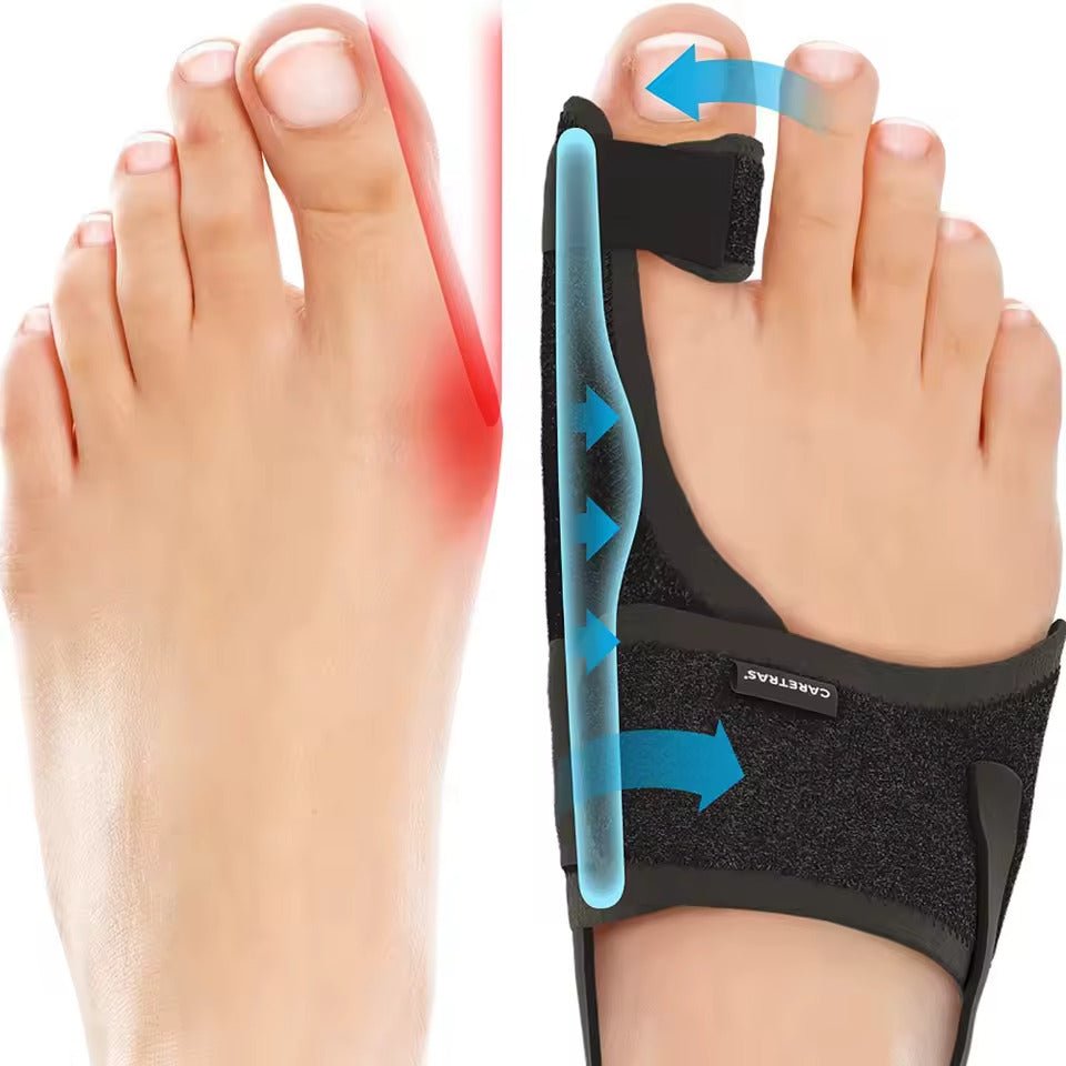 Emeja | Nachtspalk voor Hallux Valgus - Ergonomisch en Verstelbaar Comfort