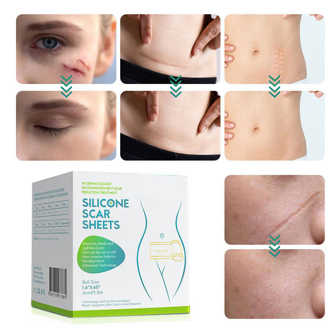 Emeja | Silicium Littekentape Rol