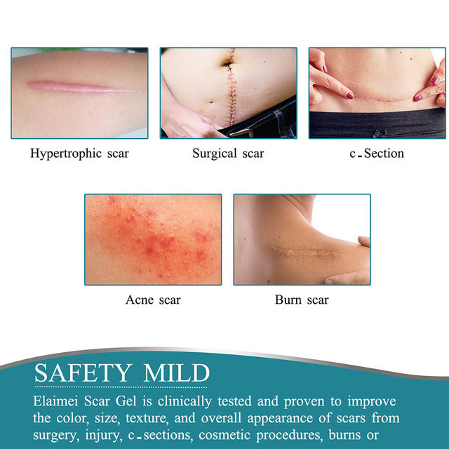 Emeja | Silicium Littekentape Rol