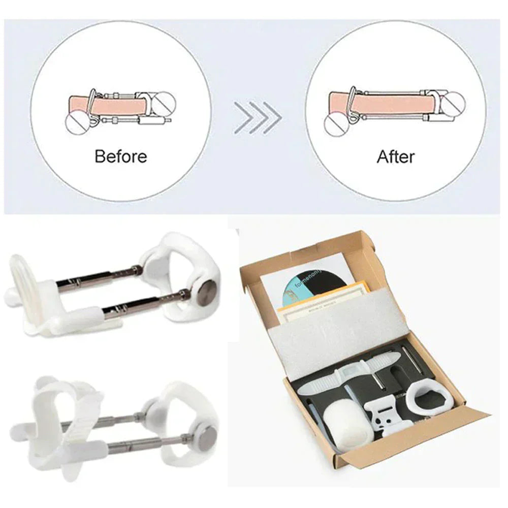 Mannelijke Groei Up Groter Extender Vergroting - Stretcher Traction Device