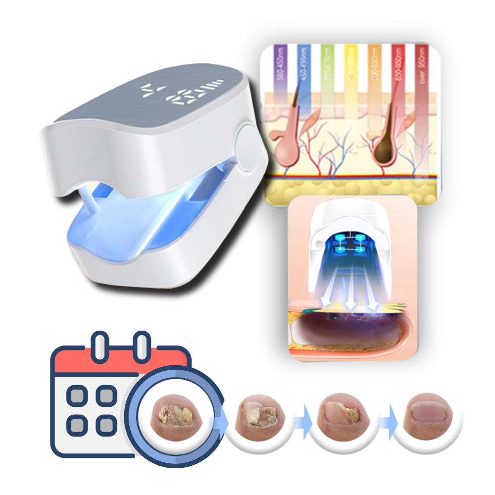 Pijnloze Nagelschimmel Laser