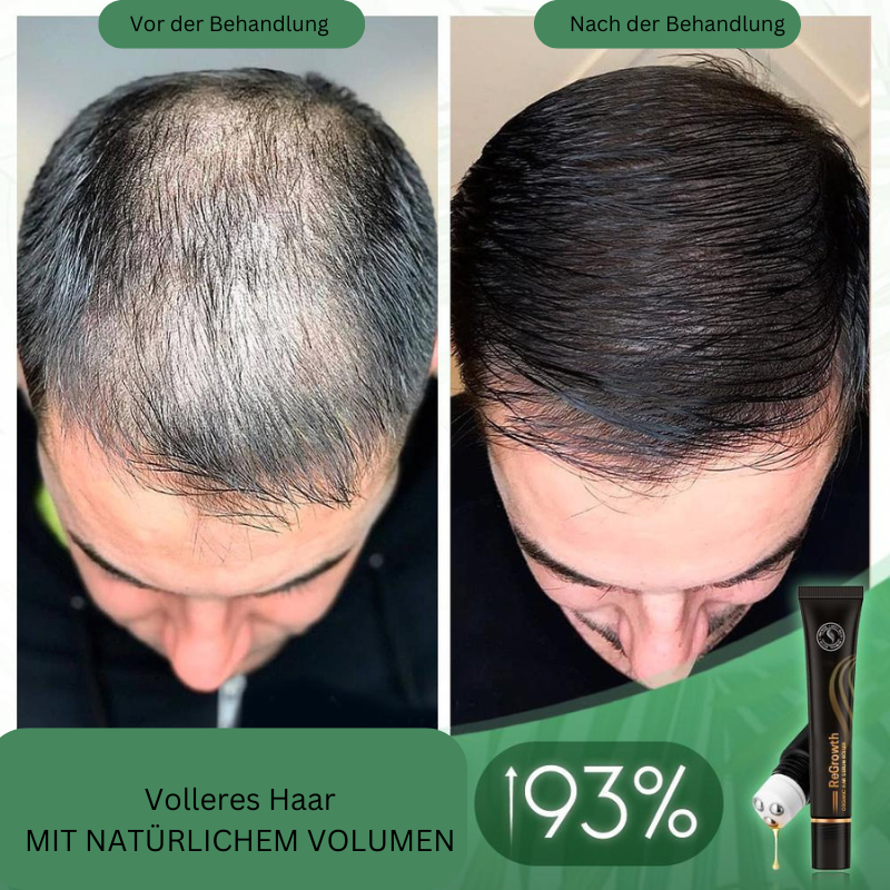 Regrowth Bio-Haar Serum Roller (Koop 1 Krijg 1 Gratis)