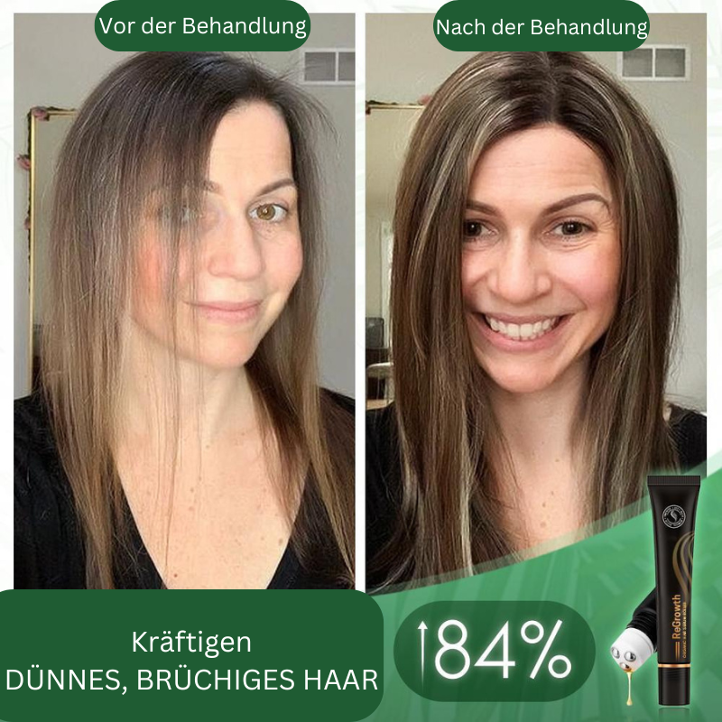 Regrowth Bio-Haar Serum Roller (Koop 1 Krijg 1 Gratis)