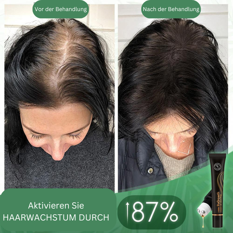 Regrowth Bio-Haar Serum Roller (Koop 1 Krijg 1 Gratis)