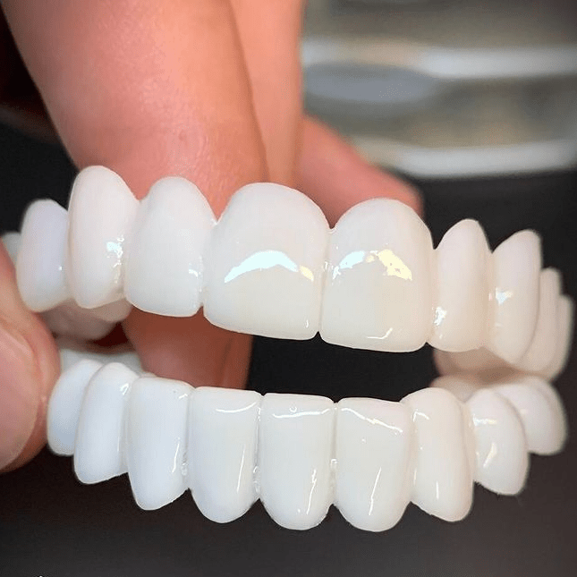 SMILEFLEX – Tandprothese met Witte Tandlenzen