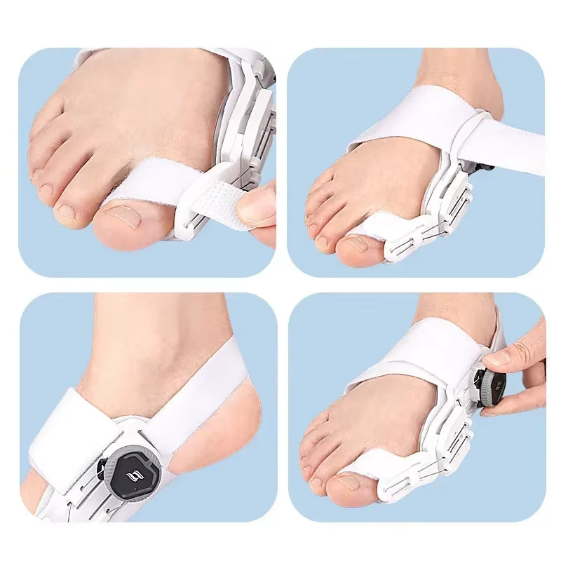Tenencorrector voor Hallux Valgus met Verstelbare Ondersteuning